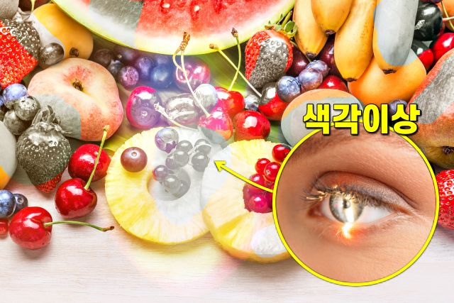 실명 전조증상 5, 눈 색깔이 바껴요, 팁줌