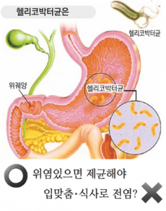 헬리코 박터 균