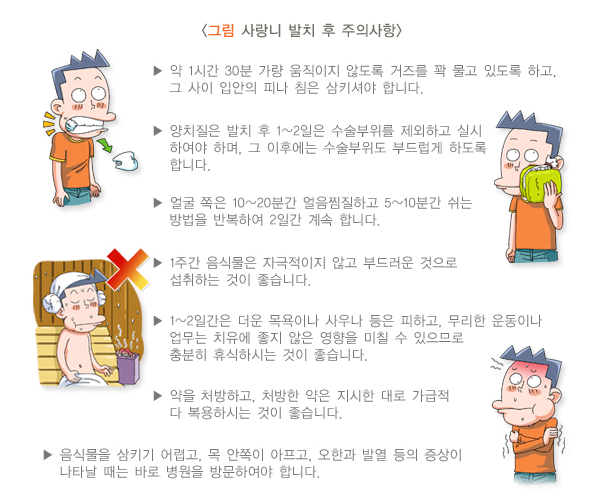 사랑니 발치