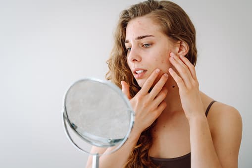 기미패치 올리브영 기미패치 검버섯패치 효과 총정리