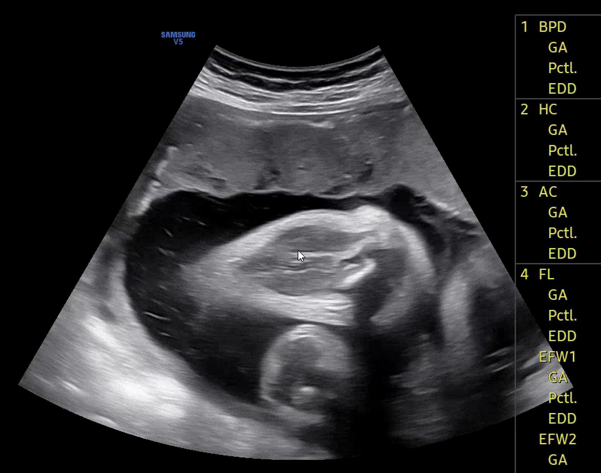 분류 클래스 예시 (no_xxx)