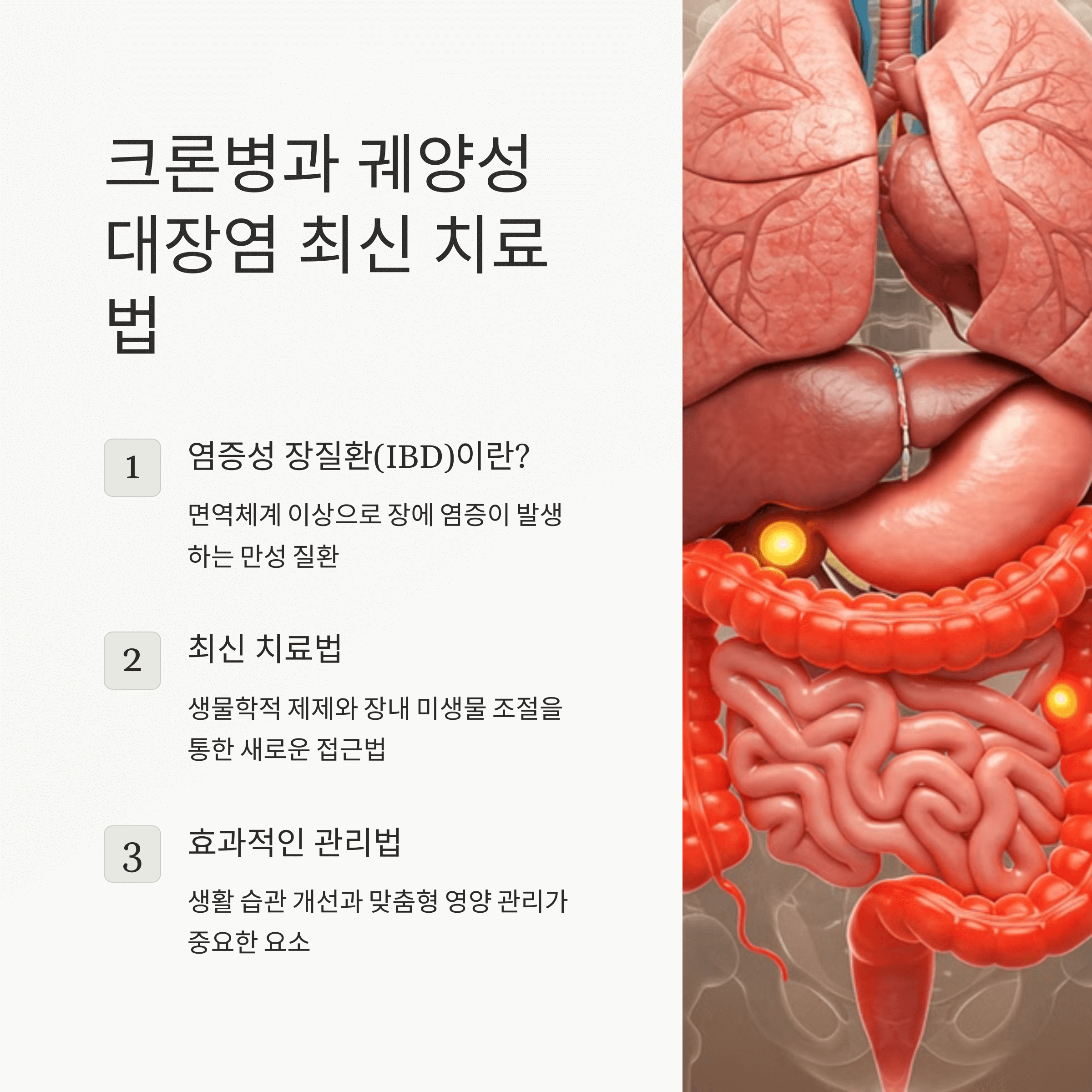 크론병과 궤양성대장염 (최신 치료법과 관리법)