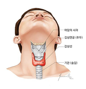땀 많은 체질