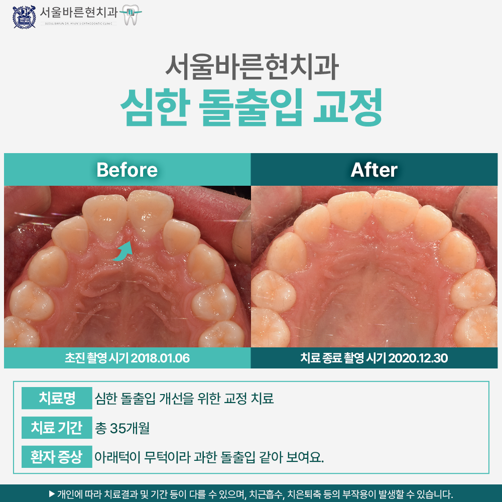 해운대교정치과
