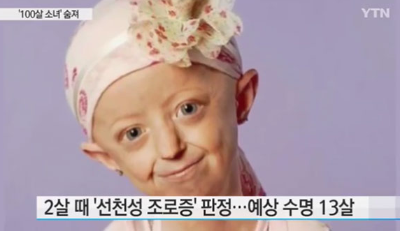 조로증 증상 원인 평균 수명 소아 진단 방법 치료제 영어로