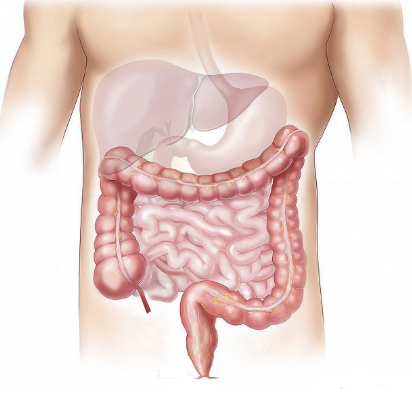 장 건강이 면연력에 미치는 영향