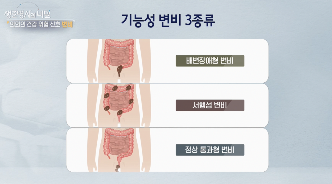 생로병사의 비밀, 변비, 몸이 보내는 위험신호