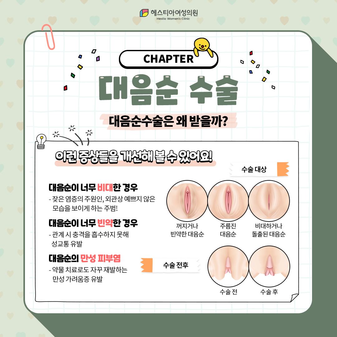 대음순수술은 왜 받을까?