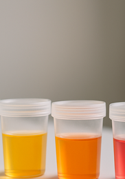 소변 색깔로 보는 건강 &amp;#124; 정상 색&amp;#44; 이상 신호&amp;#44; 병원 방문 기준