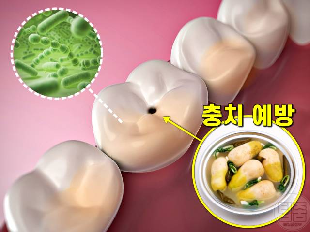 동치미 국물 효능,충치에 좋은 음식