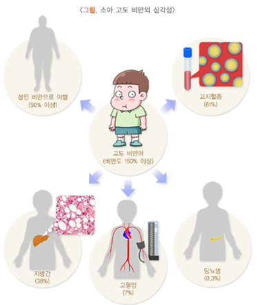 소아비만