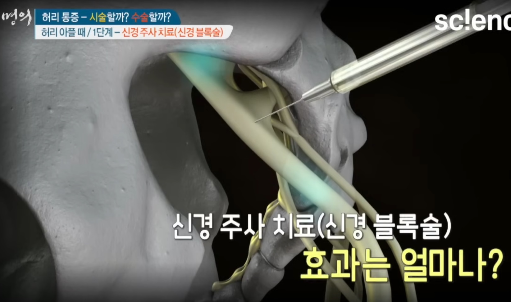 신경외과-진동규-교수