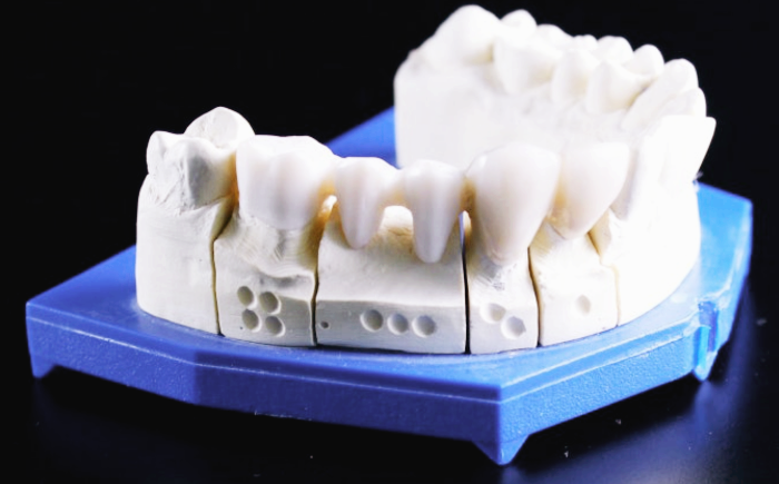 안산 임플란트 잘하는 치과