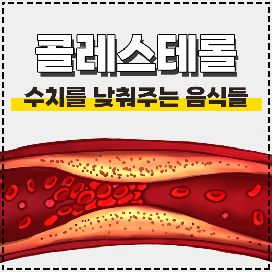 콜레스테롤 낮추는 음식