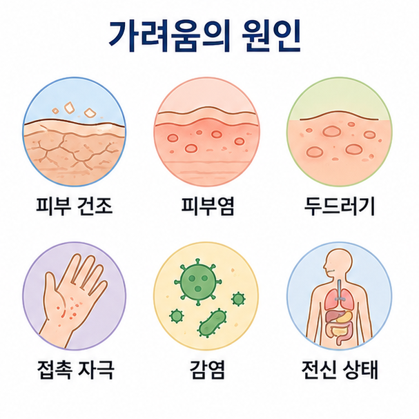 피부 건조, 피부염, 두드러기, 접촉 자극, 감염, 전신 상태 등 피부 가려움의 여러 원인을 정리한 이미지