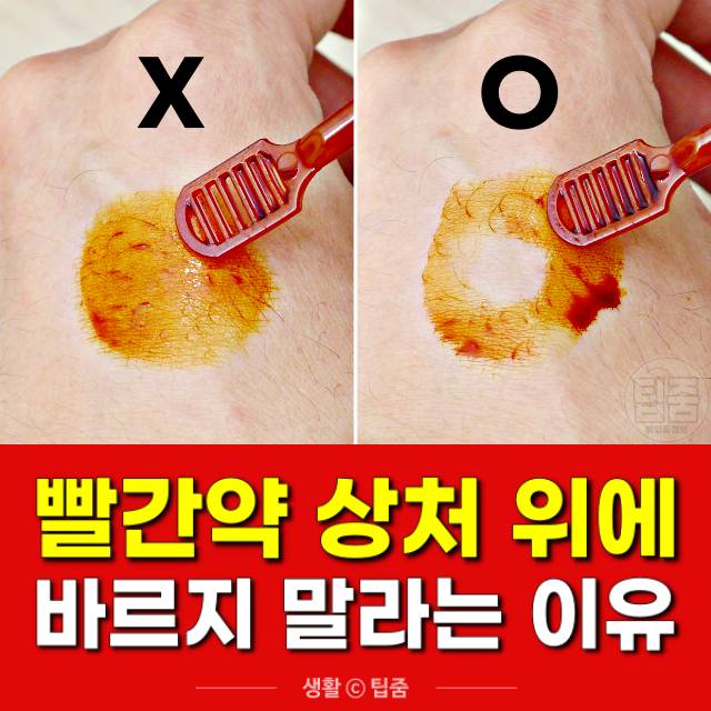 빨간약 포비돈 바르는법,빨간약 부작용,팁줌