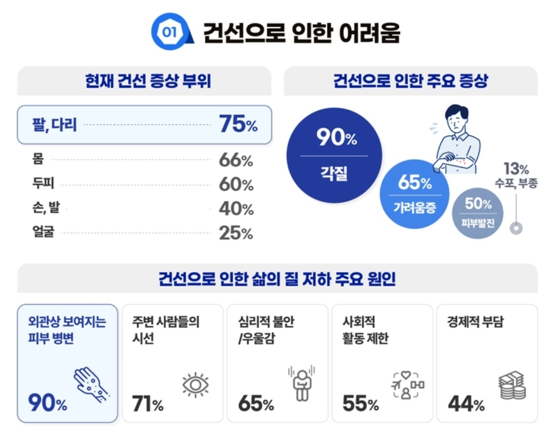 건선 증상