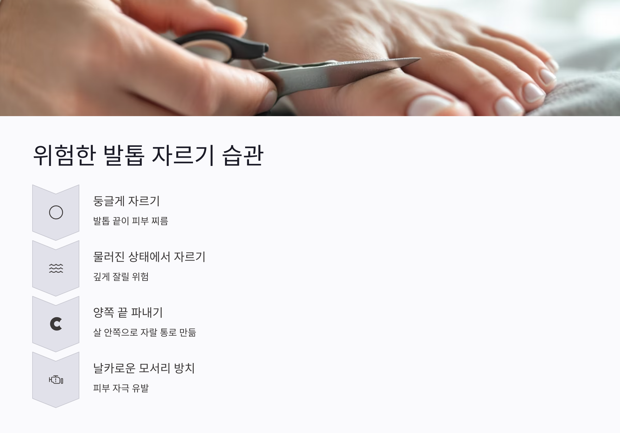 이런 발톱 자르기 습관이 위험하다