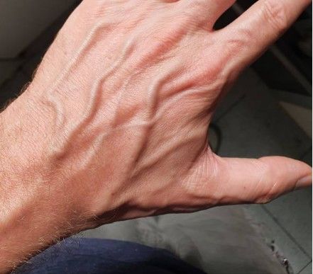 손등에 힘줄이 튀어나오는 이유