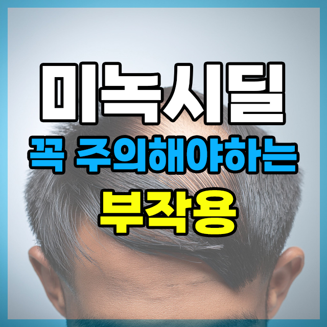 미녹시딜 꼭 주의해야하는 부작용