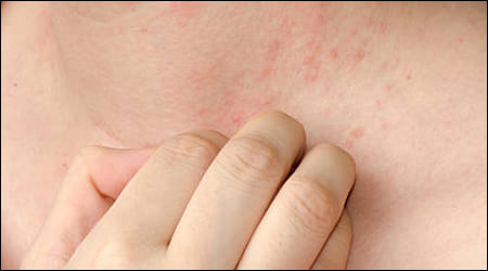 목을 긁고 있는 손