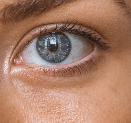 녹내장 초기증상 - 염증 관리