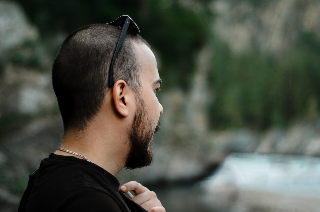 Alopecia