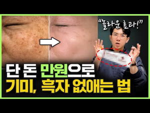기미 잡티 크림 추천