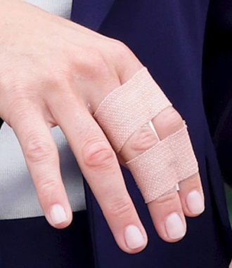 케이트미들턴-손가락부상