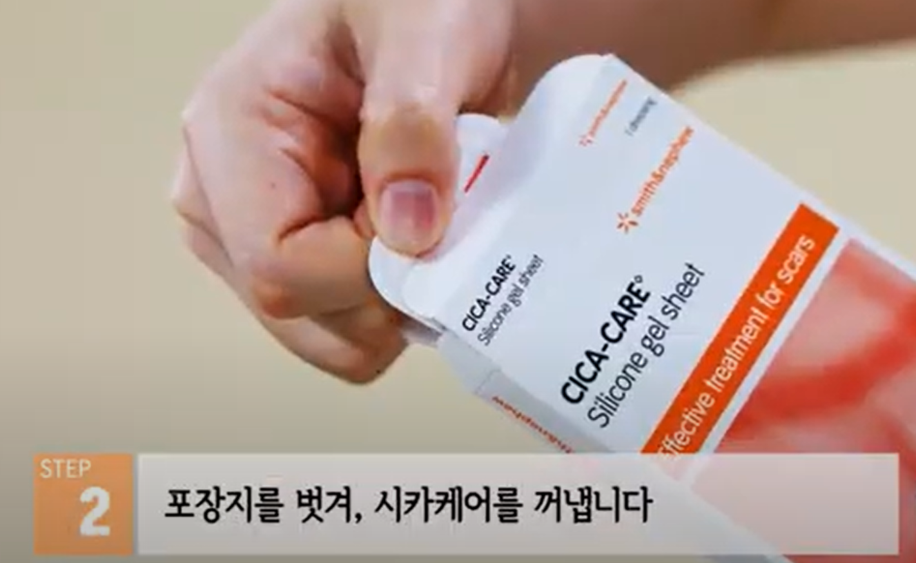 시카케어 겔시트 약국에서 사서, 제왕절개 배 흉터 관리했어요.