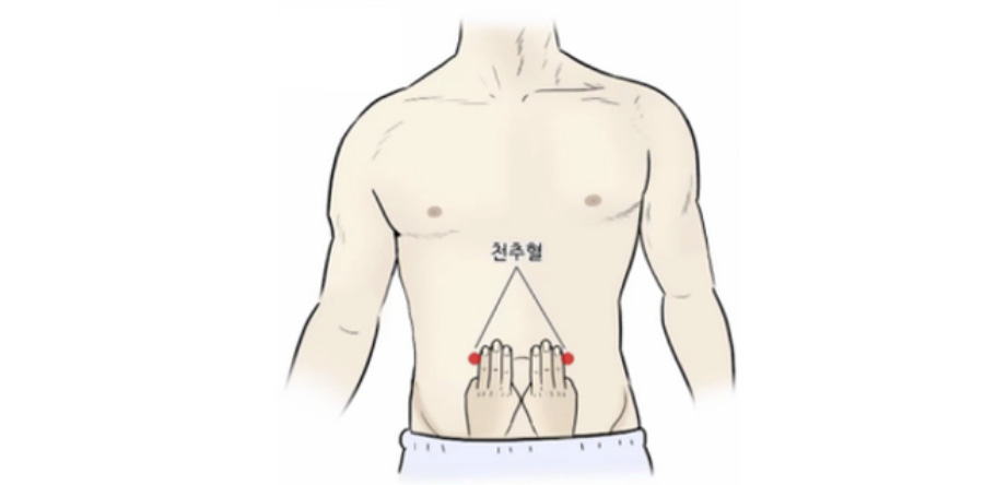 인체에 흐르는 경락 중에 배꼽 양쪽 옆으로 3~4cm쯤 떨어진 곳에 위치하고 있는 '천추'혈의 위치를 나타내주는 이미지 사진