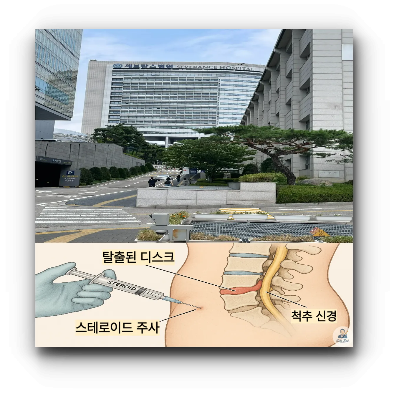 신촌-세브란스-마취통증의학과-주사치료