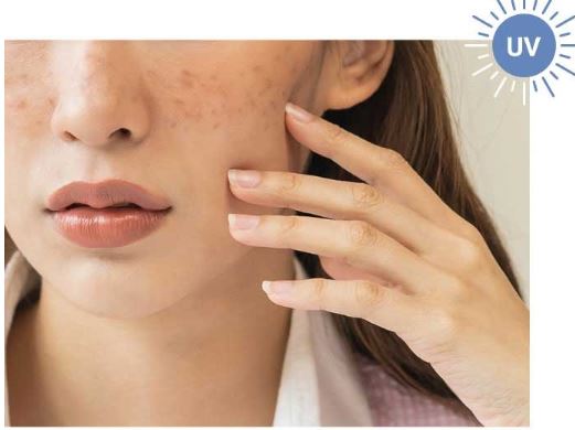 도미나크림-사용-후기