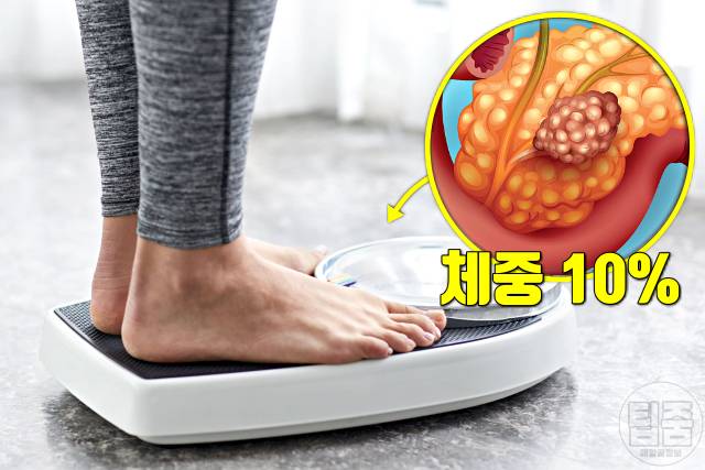 췌장암 의심증상 체중감소 췌장암 생존율 낮은 이유