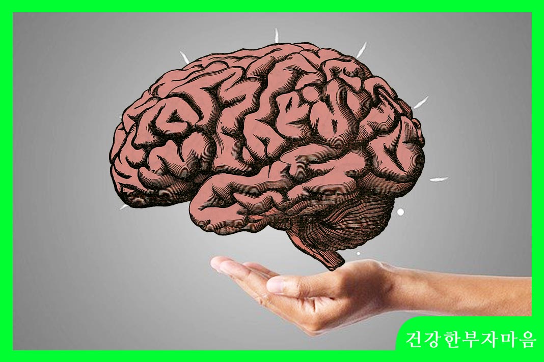 뇌출혈 후유증