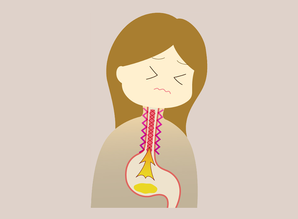 음식물이-역류하여-고통스러운-여성