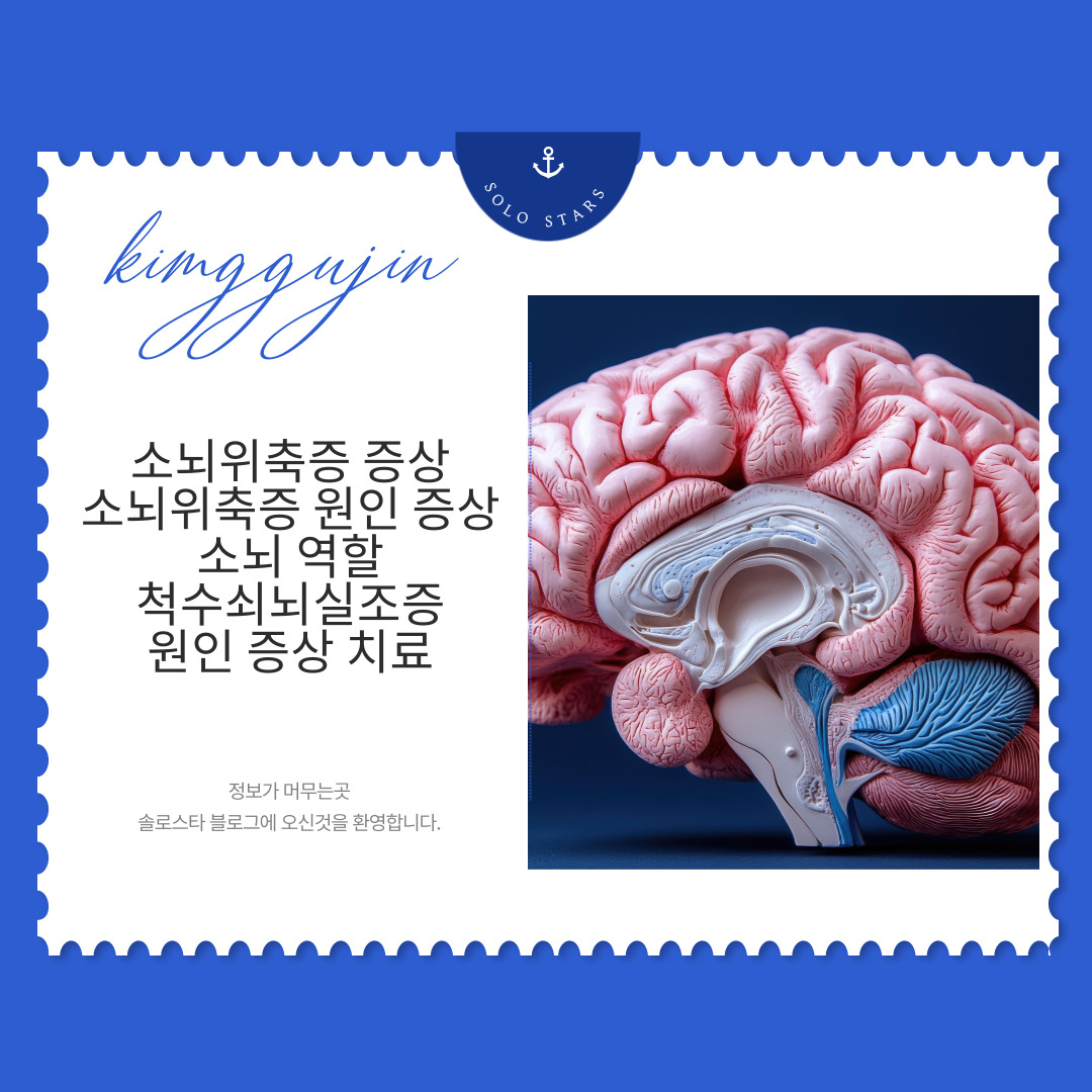 소뇌 관련 사진