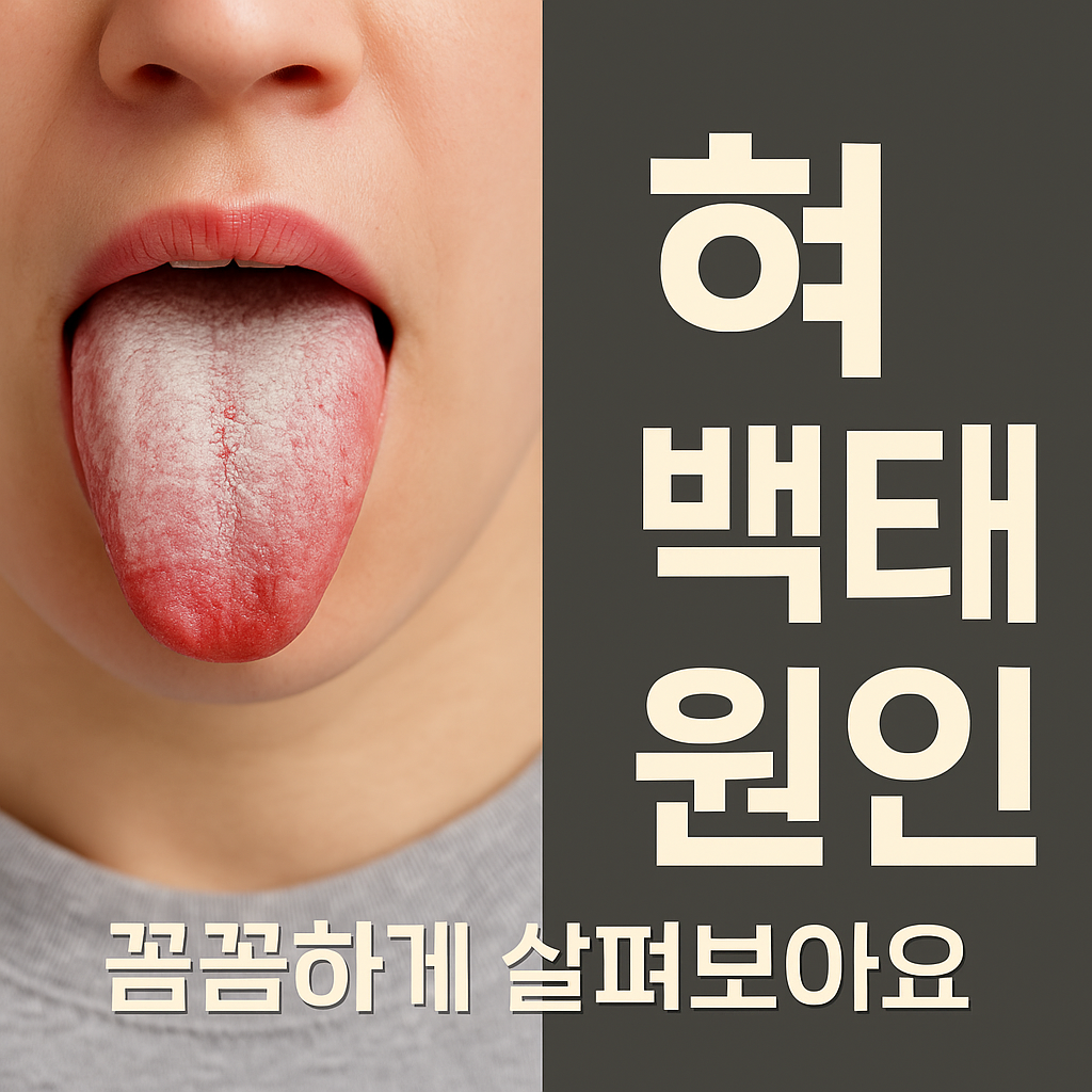 혀에 생긴 백태