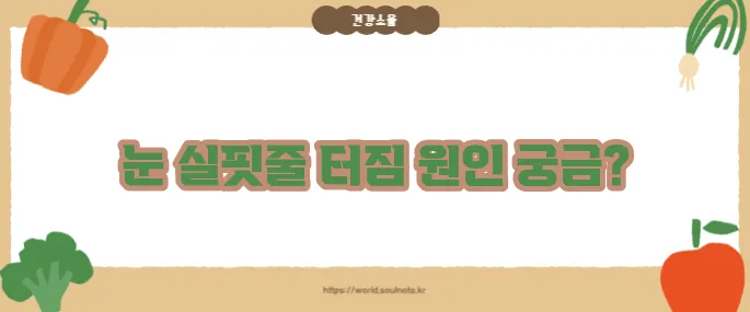 눈 실핏줄이 터지는 이유 (+주의할 질환)