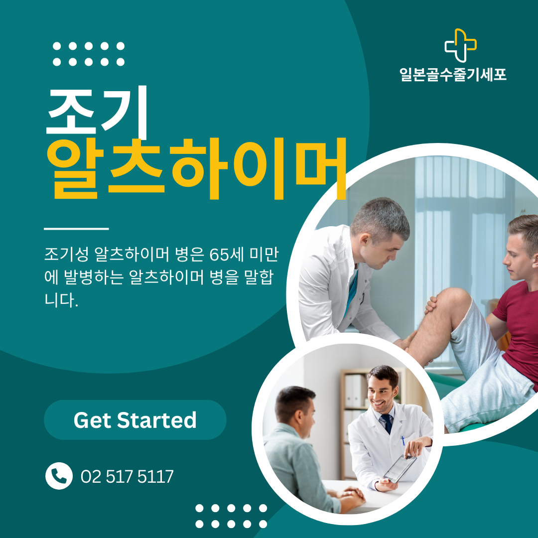 젊은 나이에 알츠하이머에 걸리기 쉬운 사람 의 특징은 알고 계십니까?