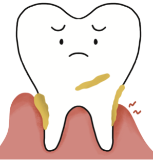 잇몸이 자주 붓는 이유