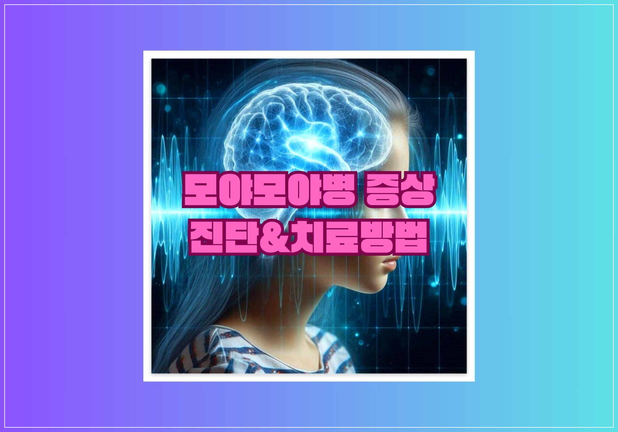 모야모야병 이해하기: 증상, 진단 및 치료 방법