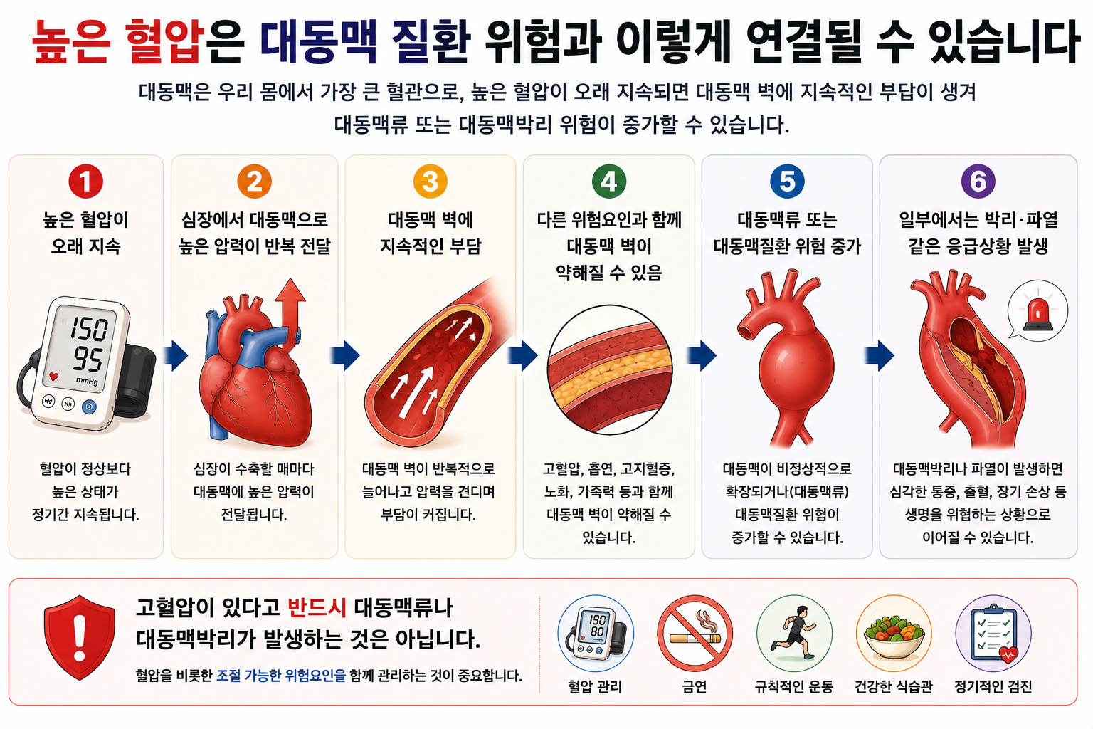 높은 혈압과 다른 위험요인이 대동맥질환 위험에 영향을 줄 수 있음을 설명하는 개념 그림