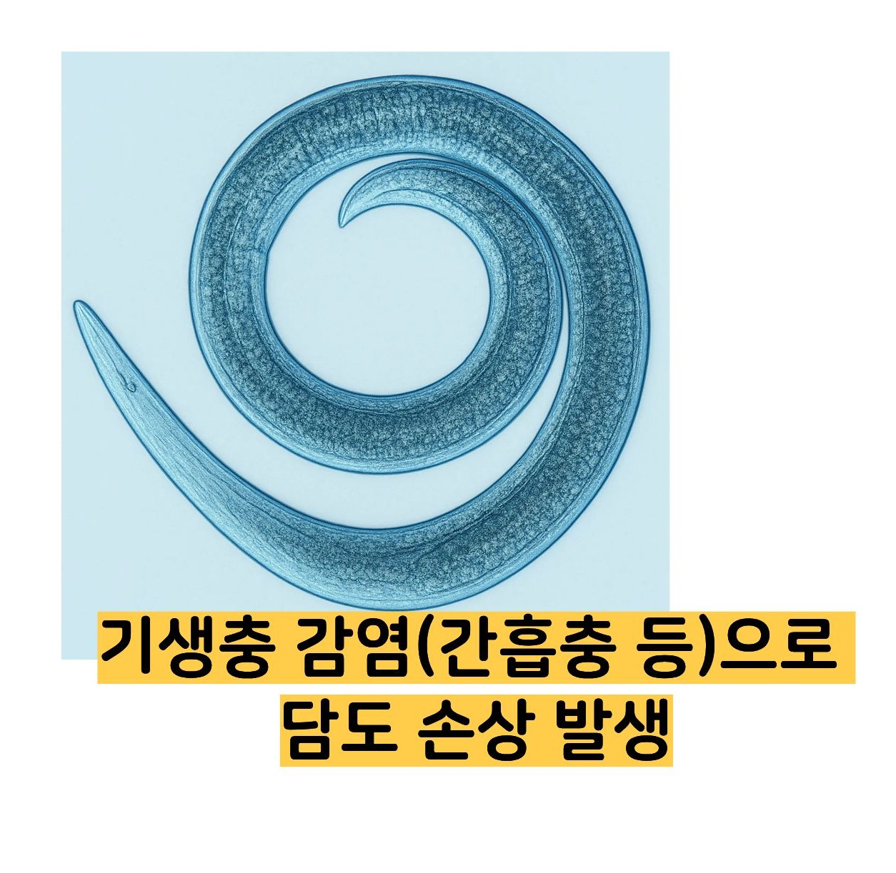 빌리루빈 수치상승 원인