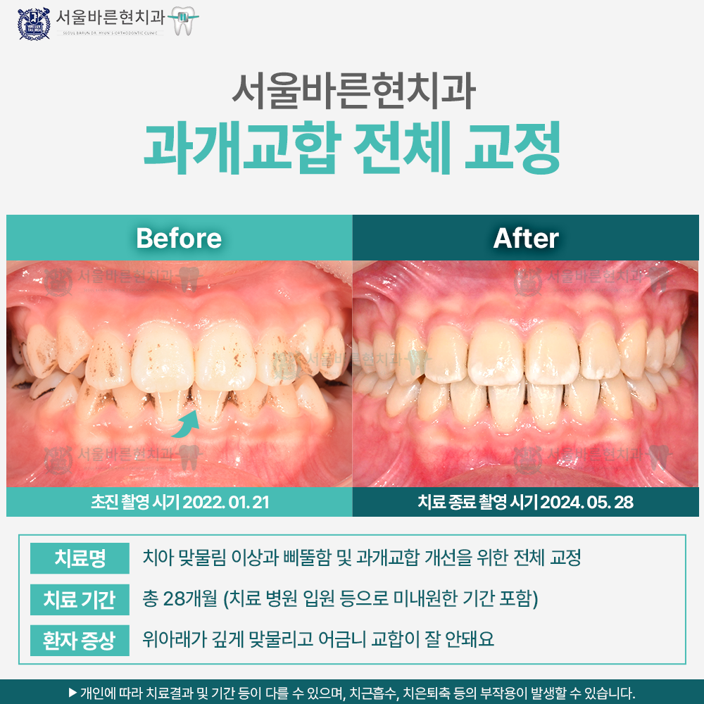 해운대교정치과