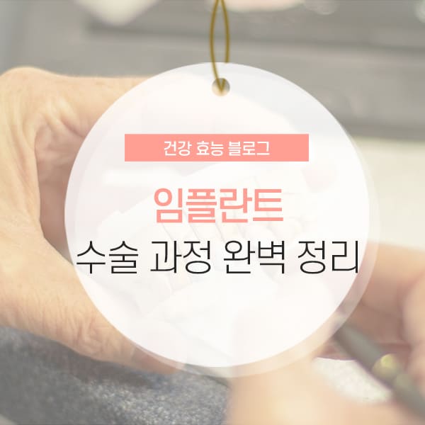 임플란트 수술과정 및 임플란트 종류 소개 콘텐츠
