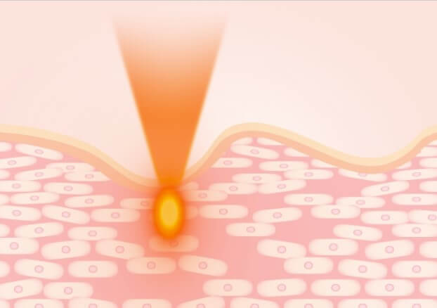 체형관리 장비 부문