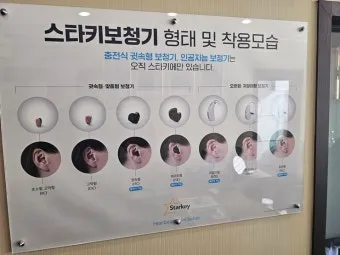 보청기 선택 귀걸이형 귓속형 배터리 교체 유지관리_11
