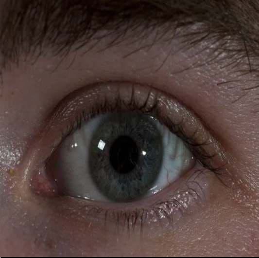 눈밑 떨림 이유 마그네슘 부족? 증상별 영양제 및 해결법