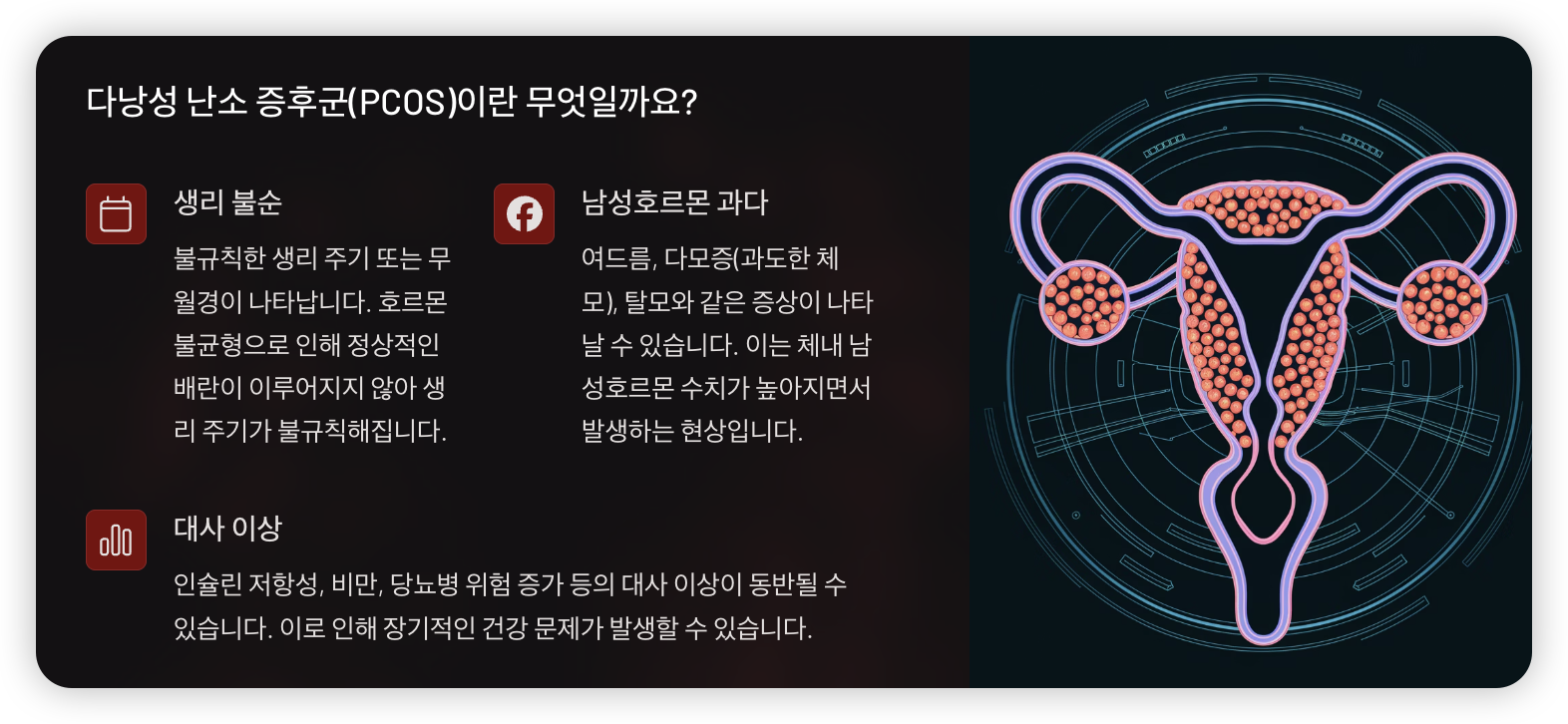 다낭성-난소-중후군